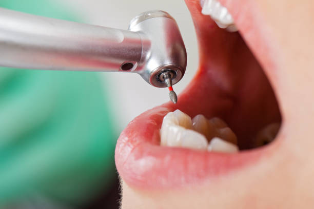 Best Pediatric Emergency Dentist in Baker City, OR